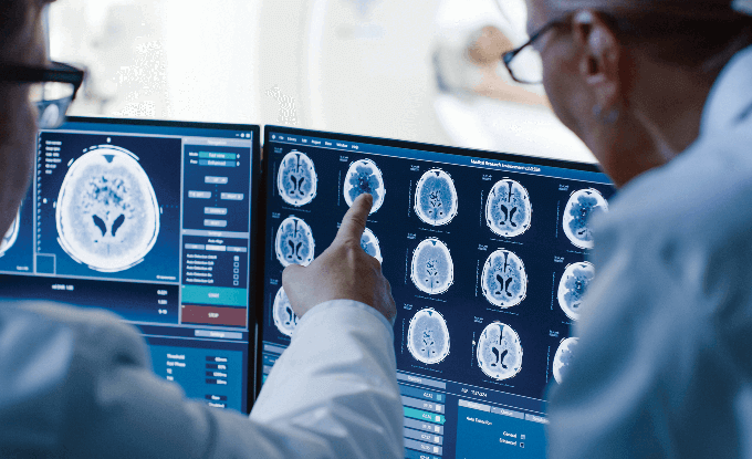 Drs looking at a brain scan.